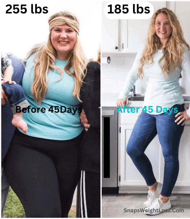 Ozempic for weight loss: Ozempic weight loss before and after pictures